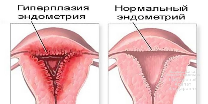 Менопауза и патология эндометрия